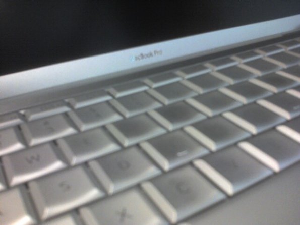 MBP